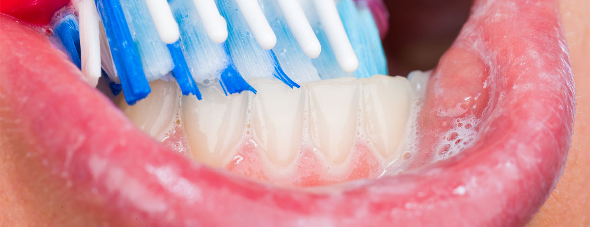 what-is-biofilm
